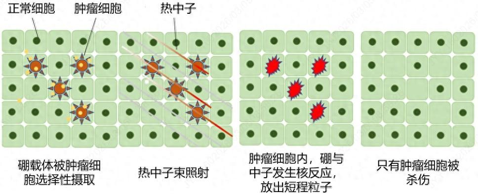 新闻